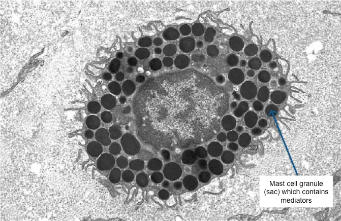 Electron micrograph of a mast cell